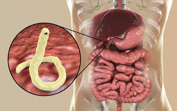 Bandwürmer und die Anzeichen eines Bandwurmbefalls – Wie erkennt man sie?