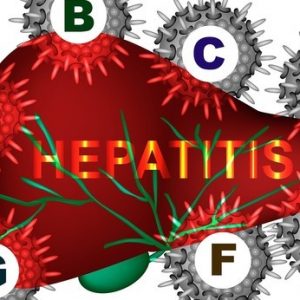 Leberentzündung, Hepatitis